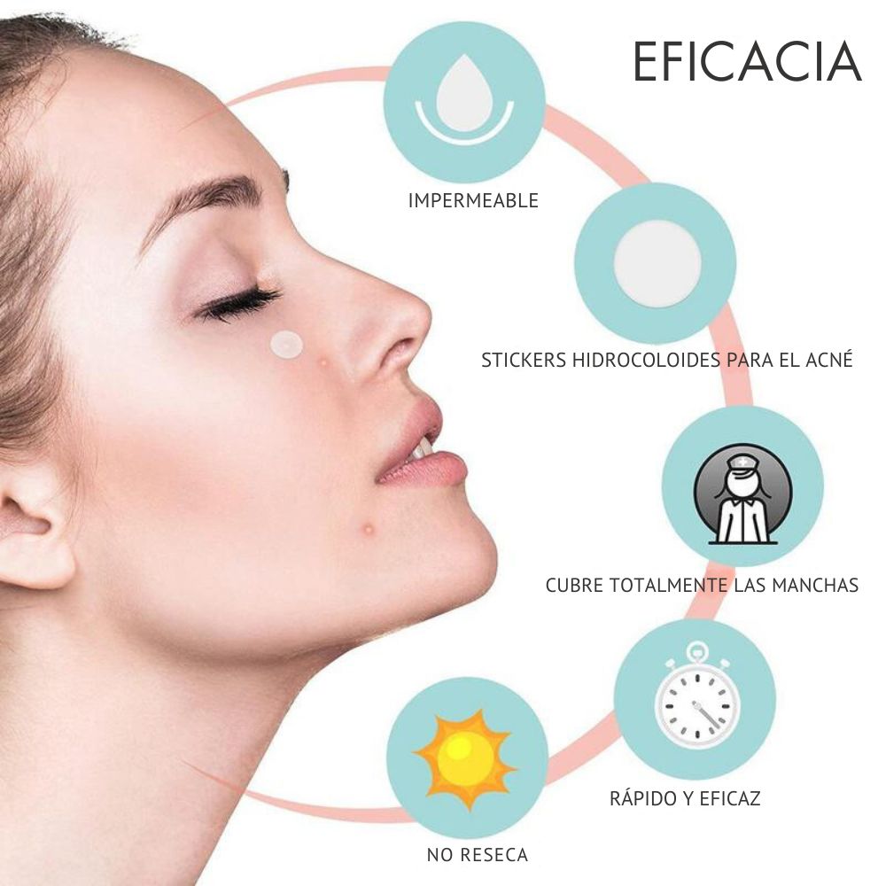 Miniatura 4 de PARCHES PARA ACNE